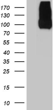 LAMP1 / CD107a Antibody (aa29-382, clone OTI8B1)