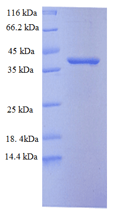 Mouse PC5 / PCSK5 Protein (Recombinant His)
