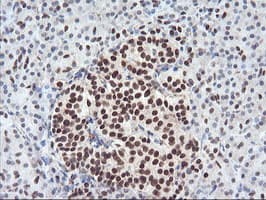 ENPEP / Aminopeptidase A Antibody (clone OTI4G8)