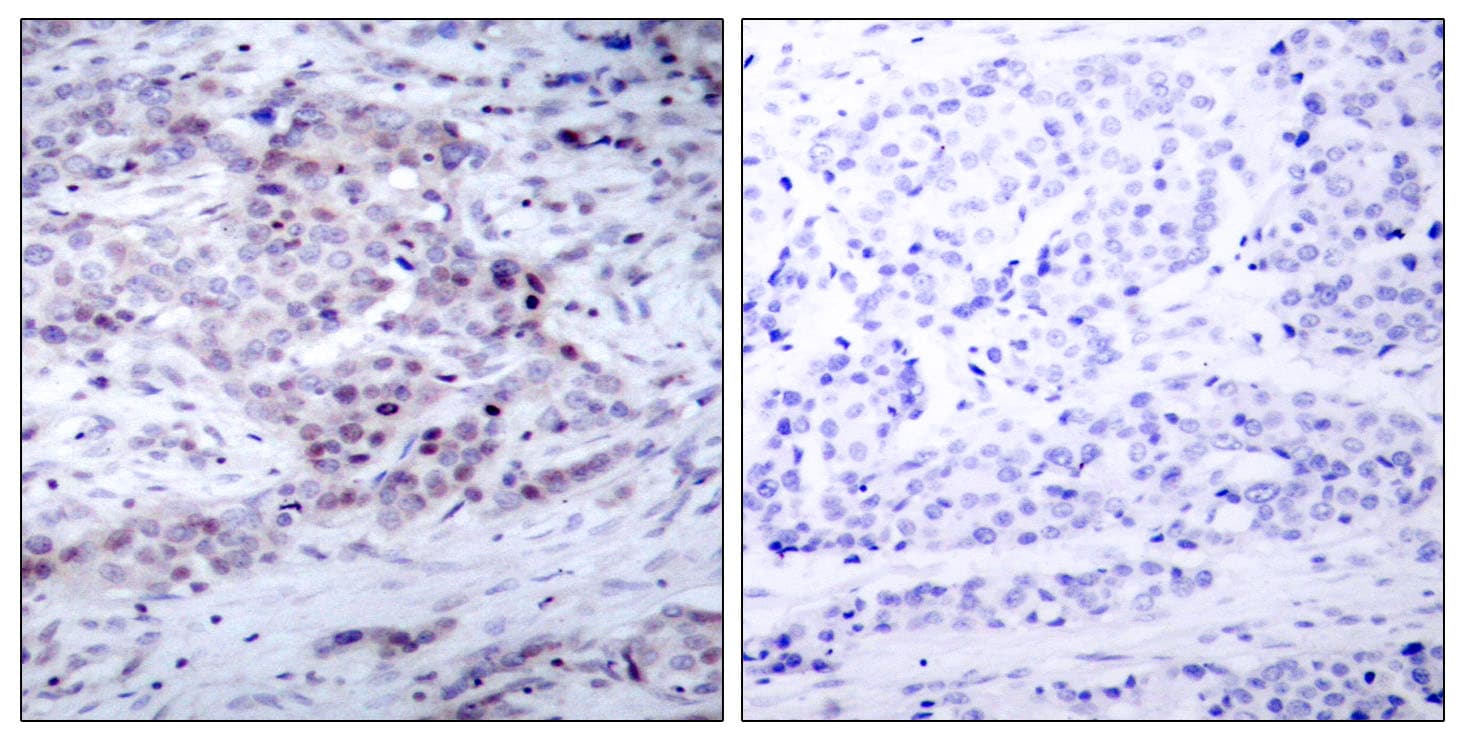 NFKB2 Antibody (phospho-Ser869)