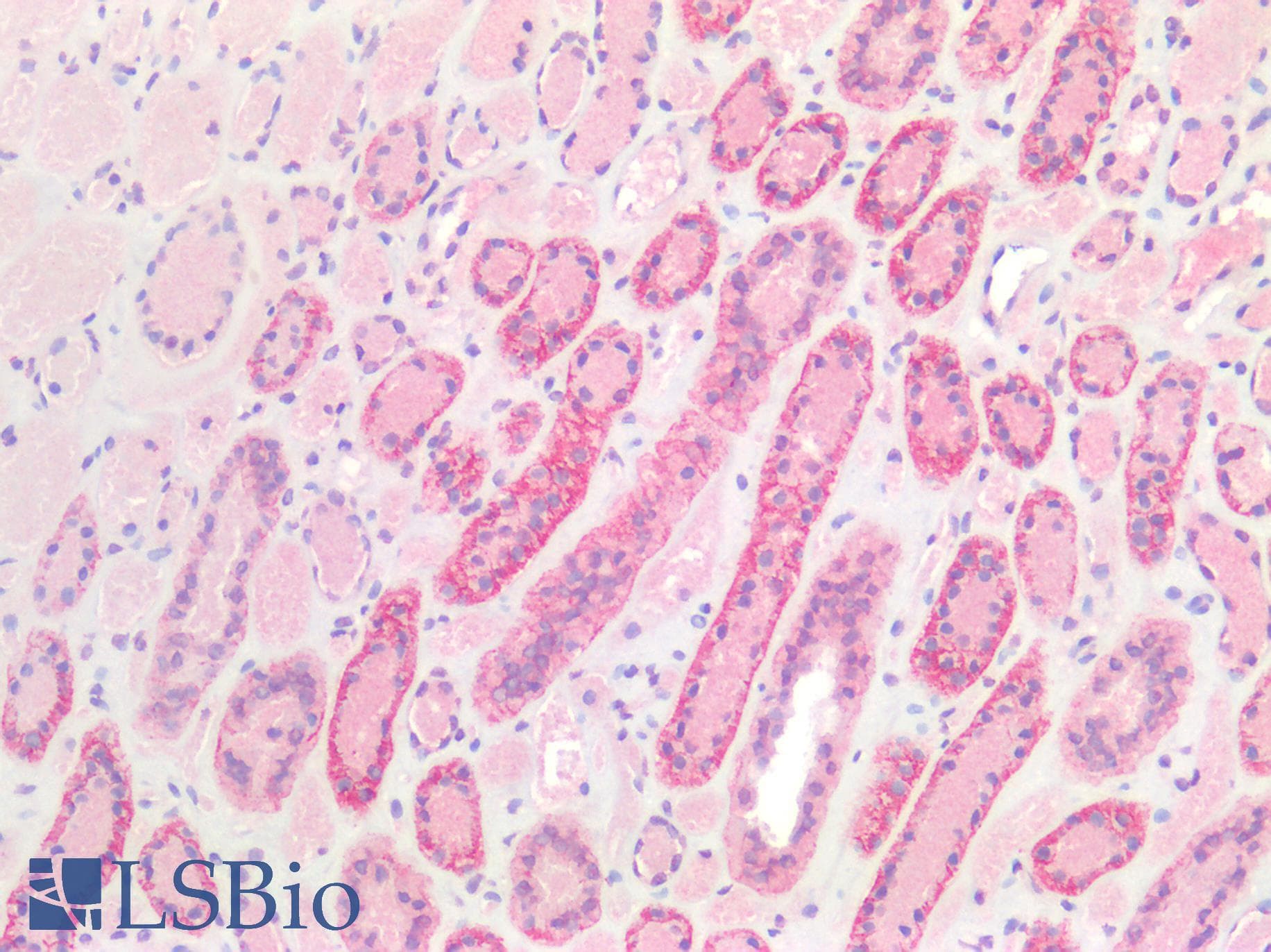 Monoclonal Mouse anti-Human CDH1 / E Cadherin Antibody (aa373-621, IHC, WB)