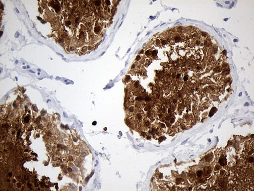 MSY2 / YBX2 Antibody (clone OTI3B5)