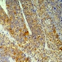 Monoclonal Mouse anti-Human PPIB / Cyclophilin B Antibody (IHC, WB)