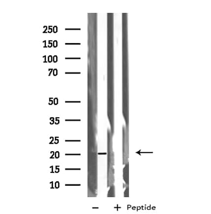 BTC / Betacellulin Antibody