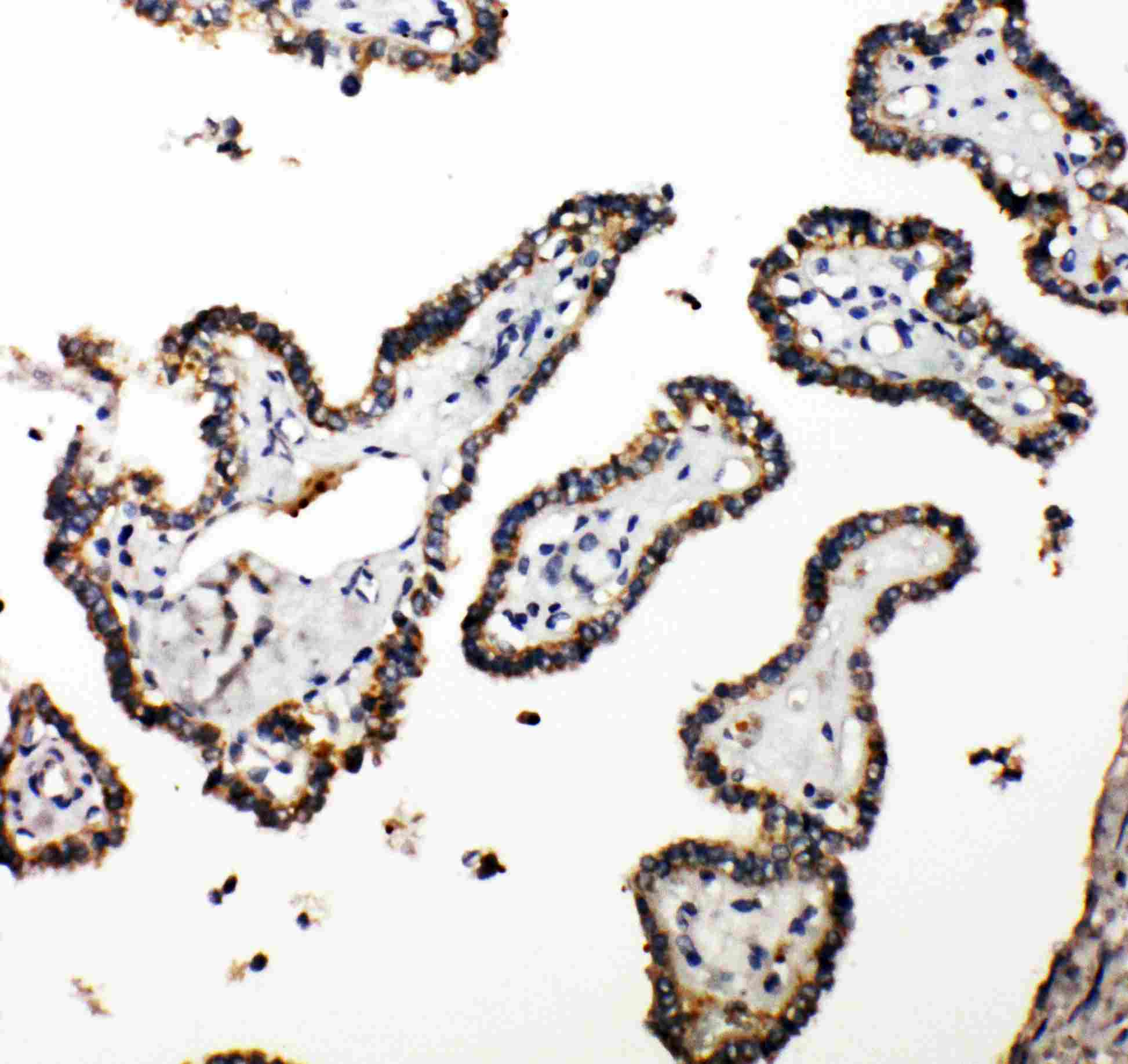 Polyclonal Rabbit anti-Human CUEDC2 Antibody (aa267-287, IHC, WB)