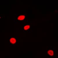 H2AFZ / H2A.z Antibody (N-Terminus)