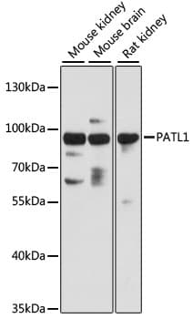 PATL1 Antibody