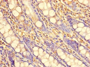 Polyclonal Rabbit anti-Human PDIK1L Antibody