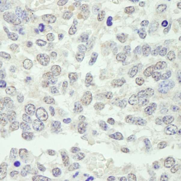 KPNA3 / Importin Alpha 4 Antibody (aa1-50)