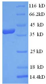 Human CPA3 Protein (Recombinant His)