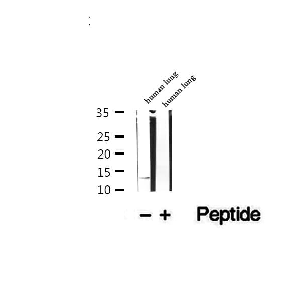 DNAJC19 Antibody