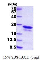 Human CSDC2 Protein (Recombinant His)