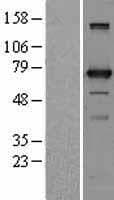 UTP3 / CRLZ1 Protein (Over-Expression Lysate Myc-DDK (Flag))