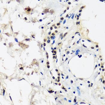TIP120 / CAND1 Antibody