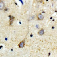 LIPG / Endothelial Lipase Antibody