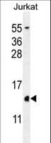 H2AFZ / H2A.z Antibody (aa59-86)