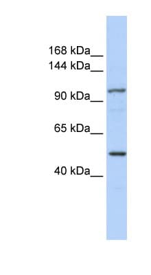 Polyclonal Rabbit anti-Human RNF213 Antibody (aa180-229, IHC, WB)