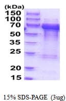 Human TOM1L2 Protein (Recombinant His)
