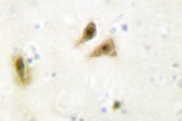 Polyclonal Rabbit anti-Human UBTF / UBF Antibody (Glu536, IHC, WB)
