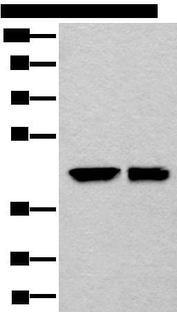DLK1 / Pref-1 Antibody
