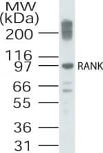 IHC-plus™ TNFRSF11A / RANK Antibody (aa603-613)