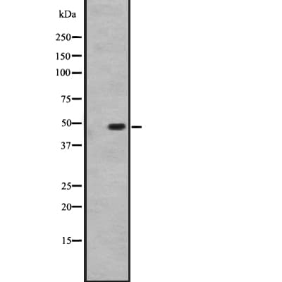 Polyclonal Rabbit anti-Human HTR1D / 5-HT1D Receptor Antibody (IHC, WB)