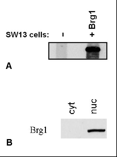 PathPlus™ SMARCA4 / BRG1 Antibody (C-Terminus, clone BRG-01)