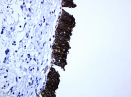 ABCB1 / MDR1 / P Glycoprotein Antibody (aa995-1280, clone 6H2, Carrier-free)