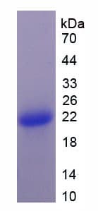 Human ACAN / Aggrecan Protein (Recombinant His-S)