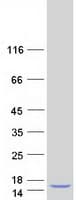 Human CCL5 / RANTES Protein (Recombinant Myc-DDK (Flag))