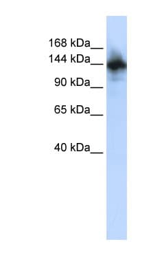 Polyclonal Rabbit anti-Human RBM6 / 3G2 Antibody (aa216-265, WB)