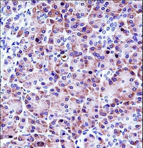Polyclonal Rabbit anti-Human CELA3A / ELA3 Antibody (aa157-186, IHC, WB)