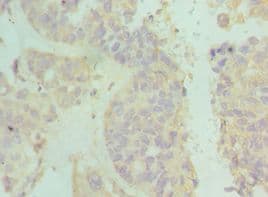 Polyclonal Rabbit anti-Human IFNAR2 Antibody (aa27-243, IHC)