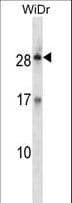 KLK12 / Kallikrein 12 Antibody (aa85-113)