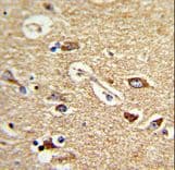 TOMM70A Antibody (aa579-608)