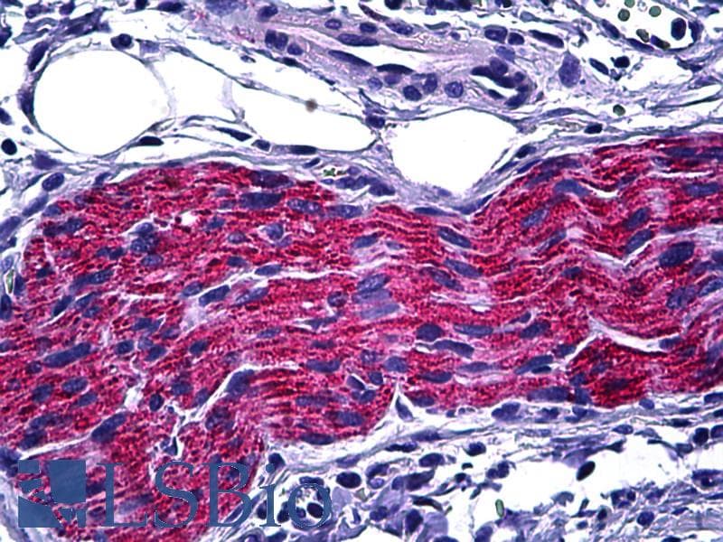 IHC-plus™ DPYSL2 / CRMP2 Antibody (aa480-529)