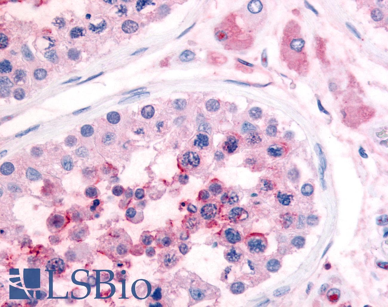 IHC-plus™ PDE3A Antibody (N-Terminus)