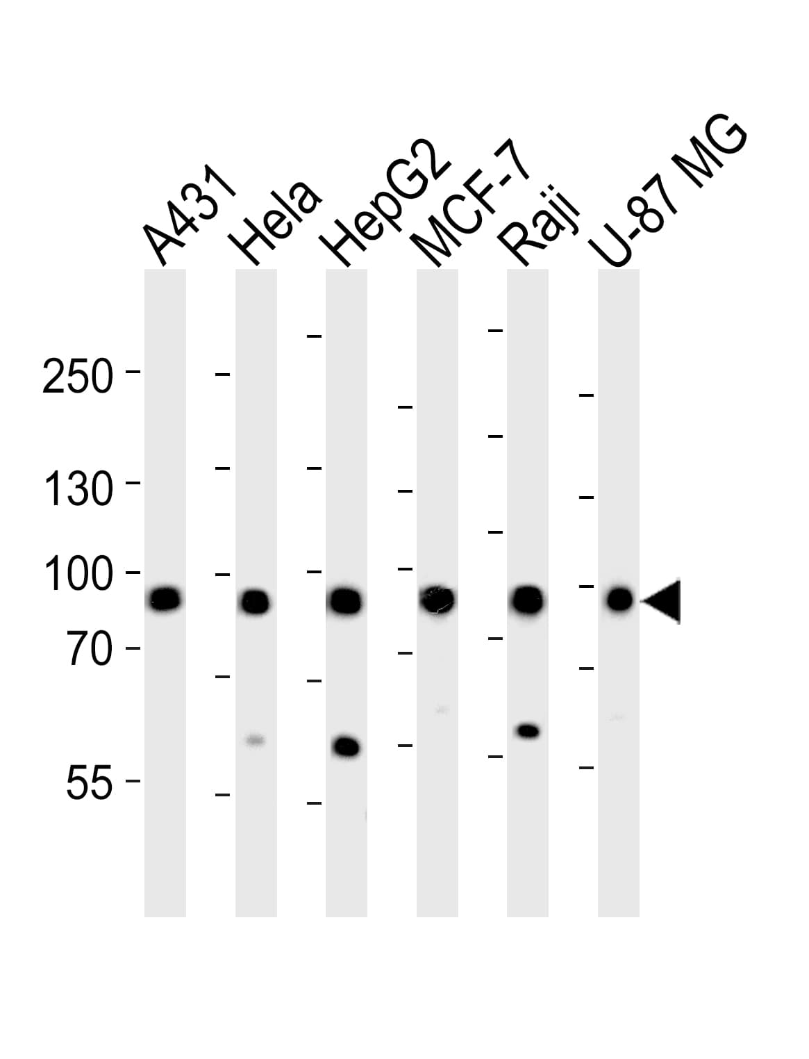 Polyclonal Rabbit anti-Human IMMT / Mitofilin Antibody (aa170-203, WB)