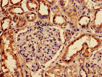 RABGGTA Antibody