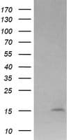 Monoclonal Mouse anti-Human LYZ / Lysozyme Antibody (clone OTI1C9, IHC, WB)