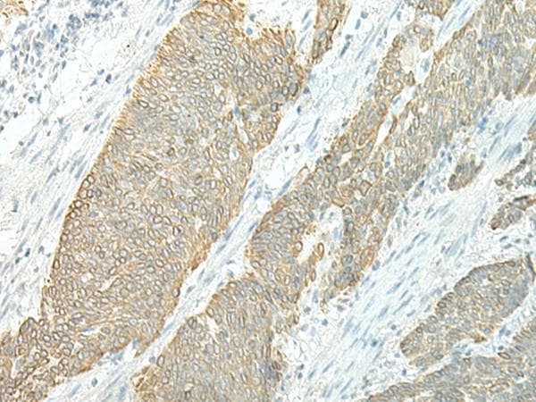 Polyclonal Rabbit anti-Human ETAA1 Antibody (IHC)