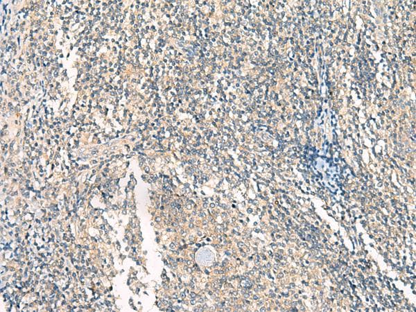 GSG2 / HASPIN Antibody