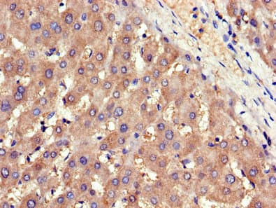 Polyclonal Rabbit anti-Human ADIPOR1/Adiponectin Receptor 1 Antibody (IHC, IF, WB)