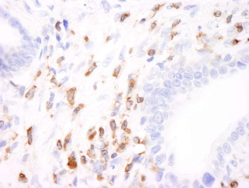 CORO1A / Coronin 1a Antibody (aa175-225)
