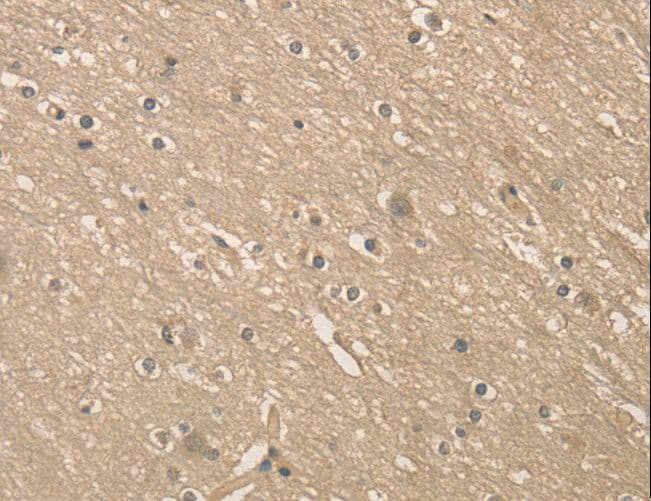 Polyclonal Rabbit anti-Human ALDH8A1 Antibody (IHC, WB)