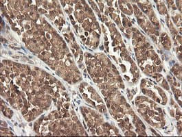 Monoclonal Mouse anti-Human PIK3CG / PI3K Gamma Antibody (clone OTI2B1, IHC, WB)