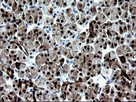 CMPK / CMPK1 Antibody (clone OTI1A1)