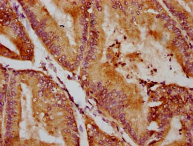 QSOX1 / QSCN6 Antibody