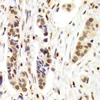 NASP Antibody