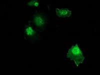 ZFAND2B Antibody (clone OTI2E4)